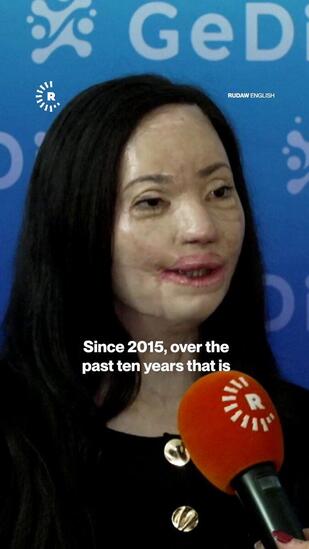 Cette jeune fille yézidie a survécu à une attaque brutale de l’EI. Depuis 10 ans, elle subit de nombreuses interventions médicales, malgré tout, elle continue de se battre @RudawEnglish