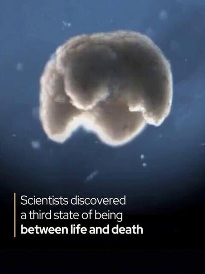 «Troisième état» entre la vie et la mort: certaines cellules refusent de mourir lorsque l'organisme meurt, dans des conditions appropriées, elles peuvent s'éveiller à une nouvelle existence @Rainmaker1973